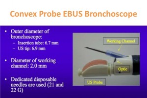 A new needle on the block: EchoTip ProCore endobronchial ultrasound needle