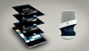 Wireless, Handheld Ultrasound For iOS and Android Debuts